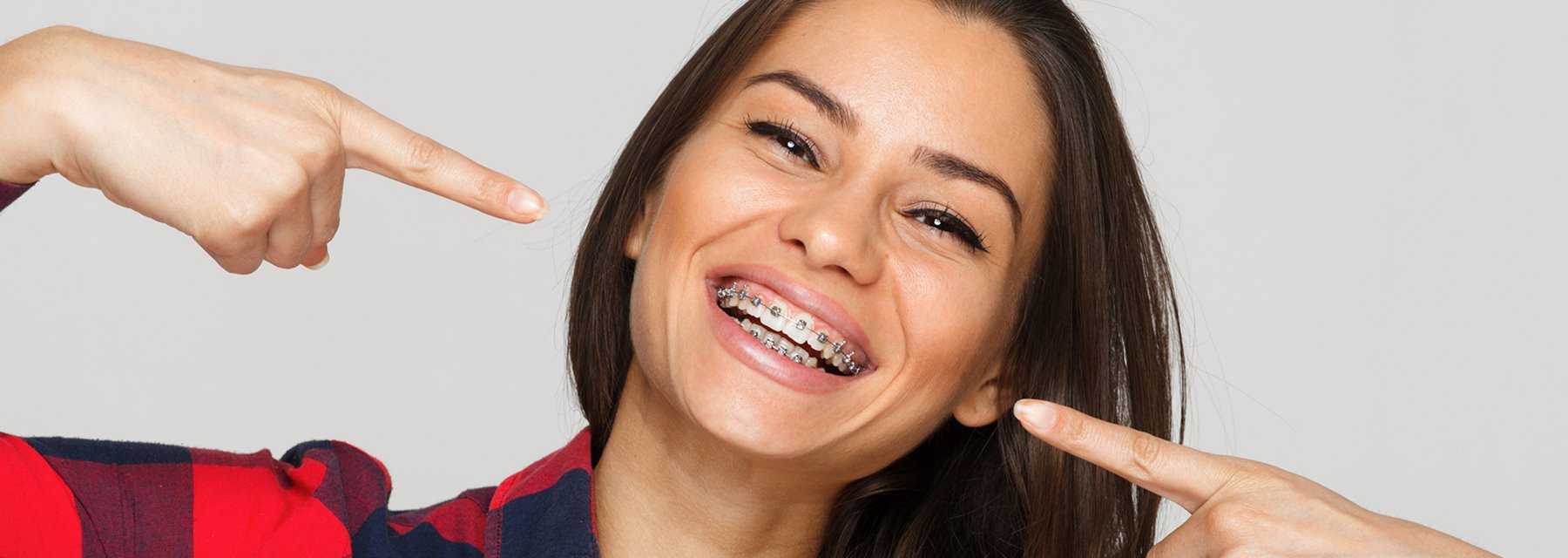 Different Types of Braces in Springboro, Ohio